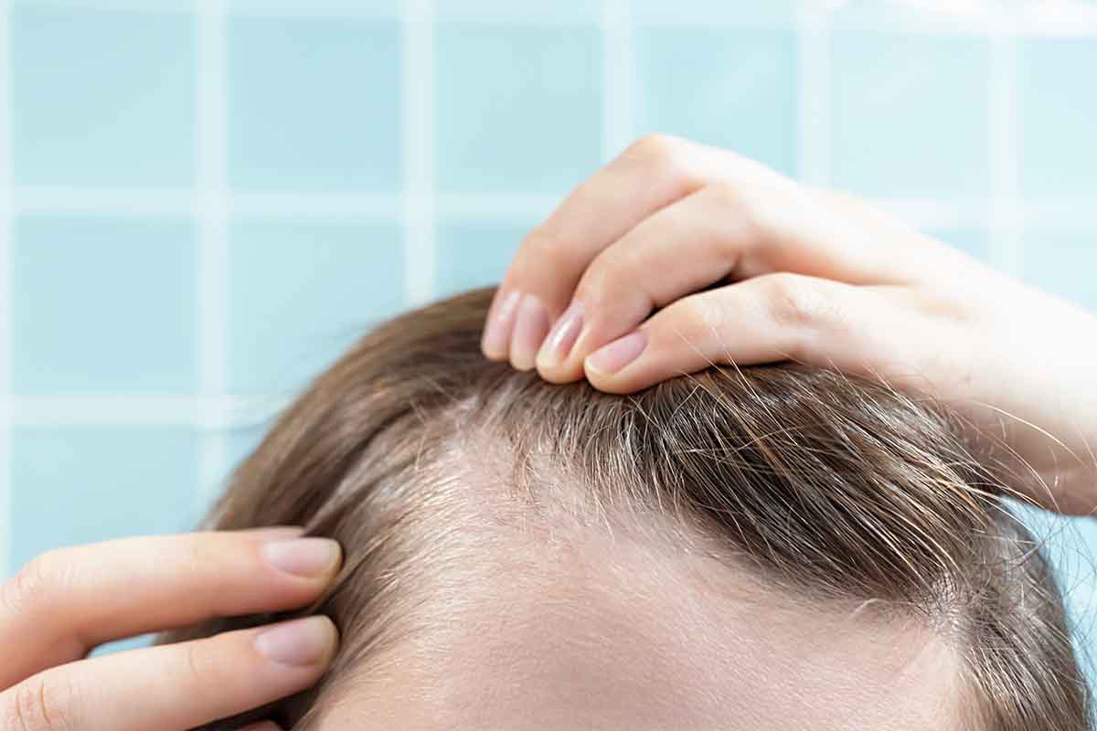 Thinning Hair Solutions