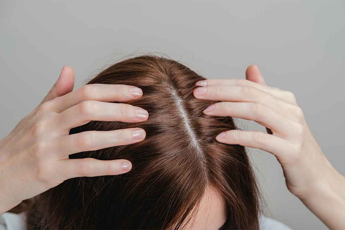 Main Reason For Hair Fall