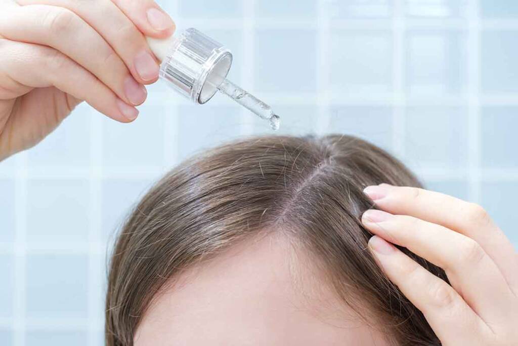 Thinning Hair Solutions