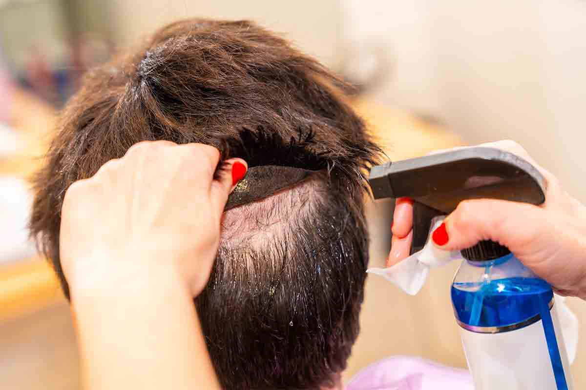 Thinning Hair Solutions